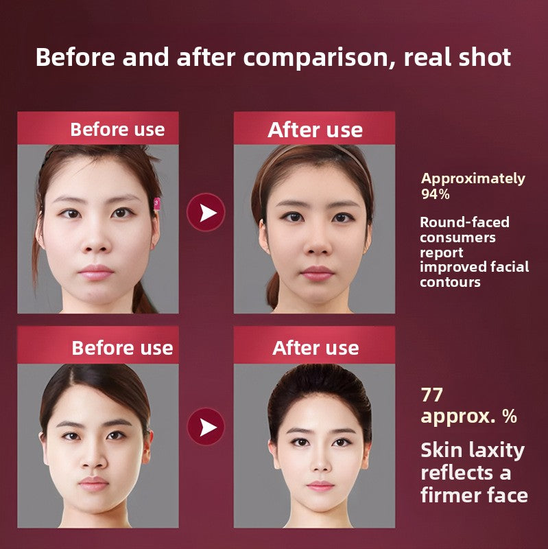 Facial Beauty Device