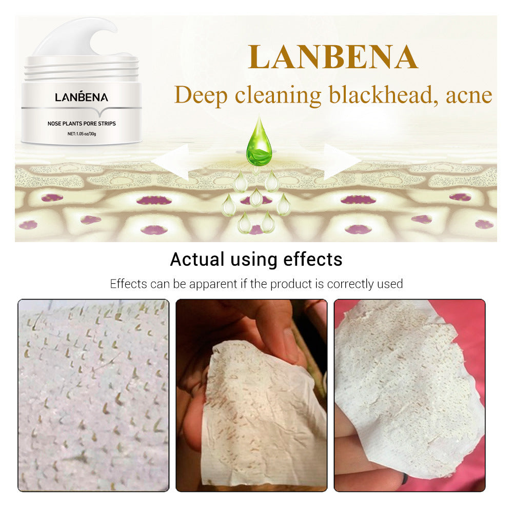 Blackhead Tearing To Remove Acne
